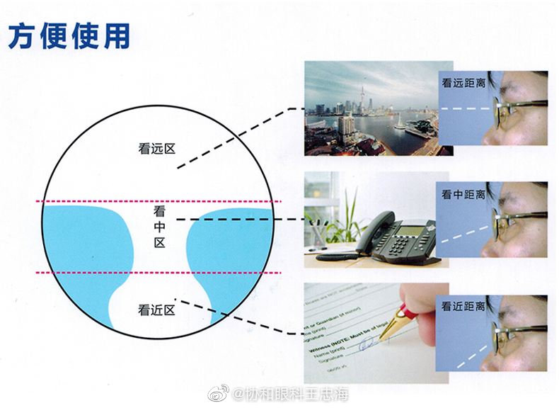 三焦点人工晶体的优点 1