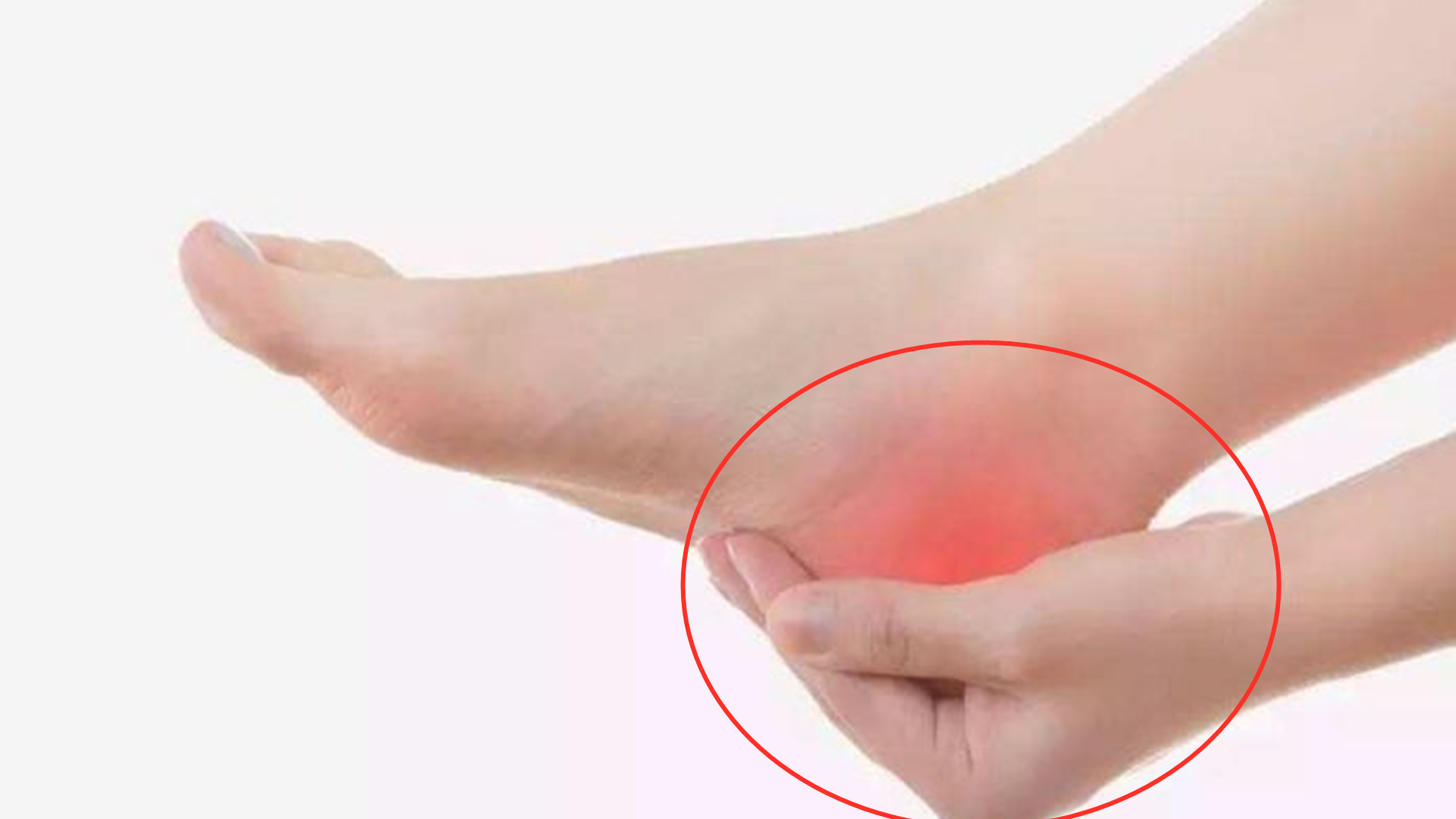 假如我们脚后跟痛,千万不要忍,可能与疾病相关|脚后跟|疾病|跟腱炎