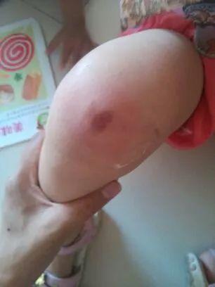 3岁男童仰头止鼻血致死！孩子常见意外应急处理的误区，你一定要知道休闲区蓝鸢梦想 - Www.slyday.coM