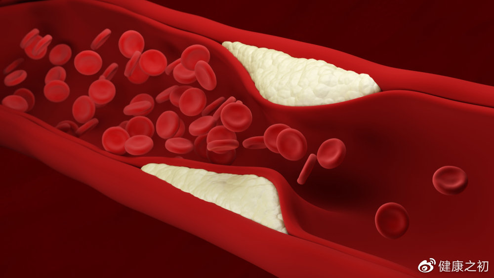 人体血管近10万千米血管的寿命决定你的寿命正确保养很关键