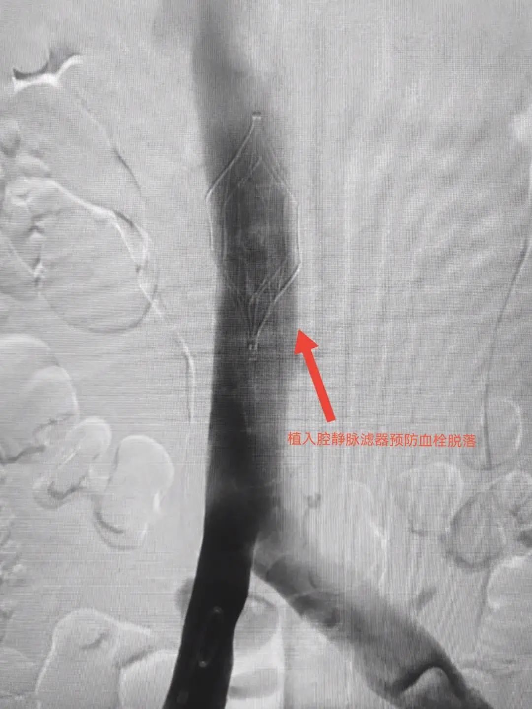 漳州一老奶奶长时间躺着玩手机，差点把命玩丢了！休闲区蓝鸢梦想 - Www.slyday.coM