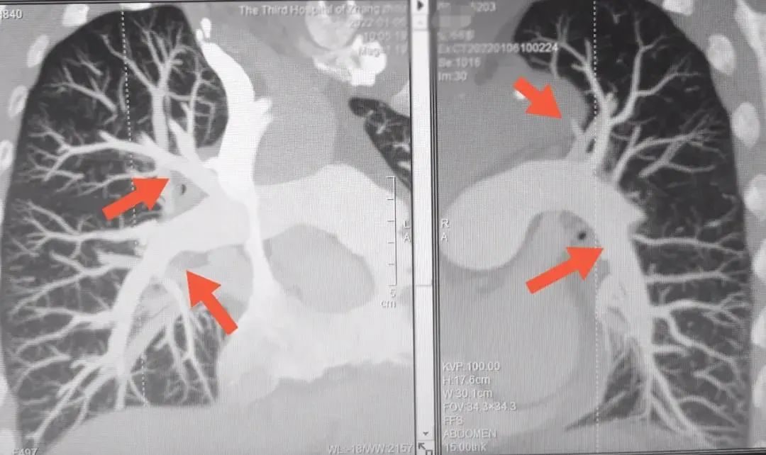 漳州一老奶奶长时间躺着玩手机，差点把命玩丢了！休闲区蓝鸢梦想 - Www.slyday.coM