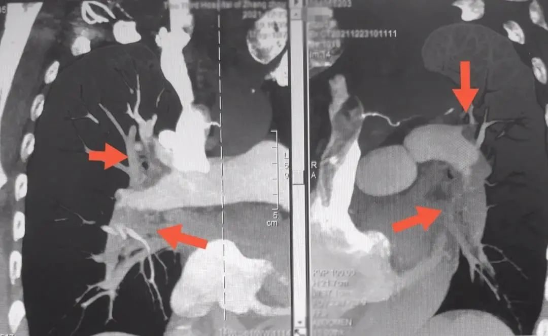 漳州一老奶奶长时间躺着玩手机，差点把命玩丢了！休闲区蓝鸢梦想 - Www.slyday.coM