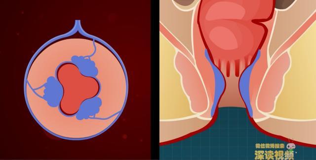 肛垫的充血功能要是不给力,大便会失禁.