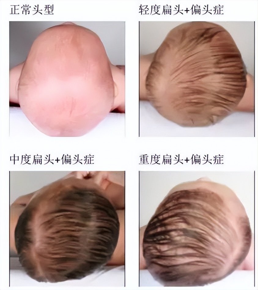 妈妈吐槽宝宝头扁,开启宝宝圆头拯救记|婴儿枕_新浪新闻