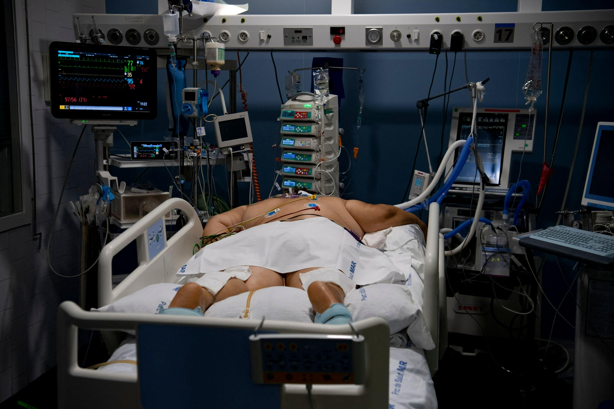 (外代一线)直击:西班牙的新冠重症病房