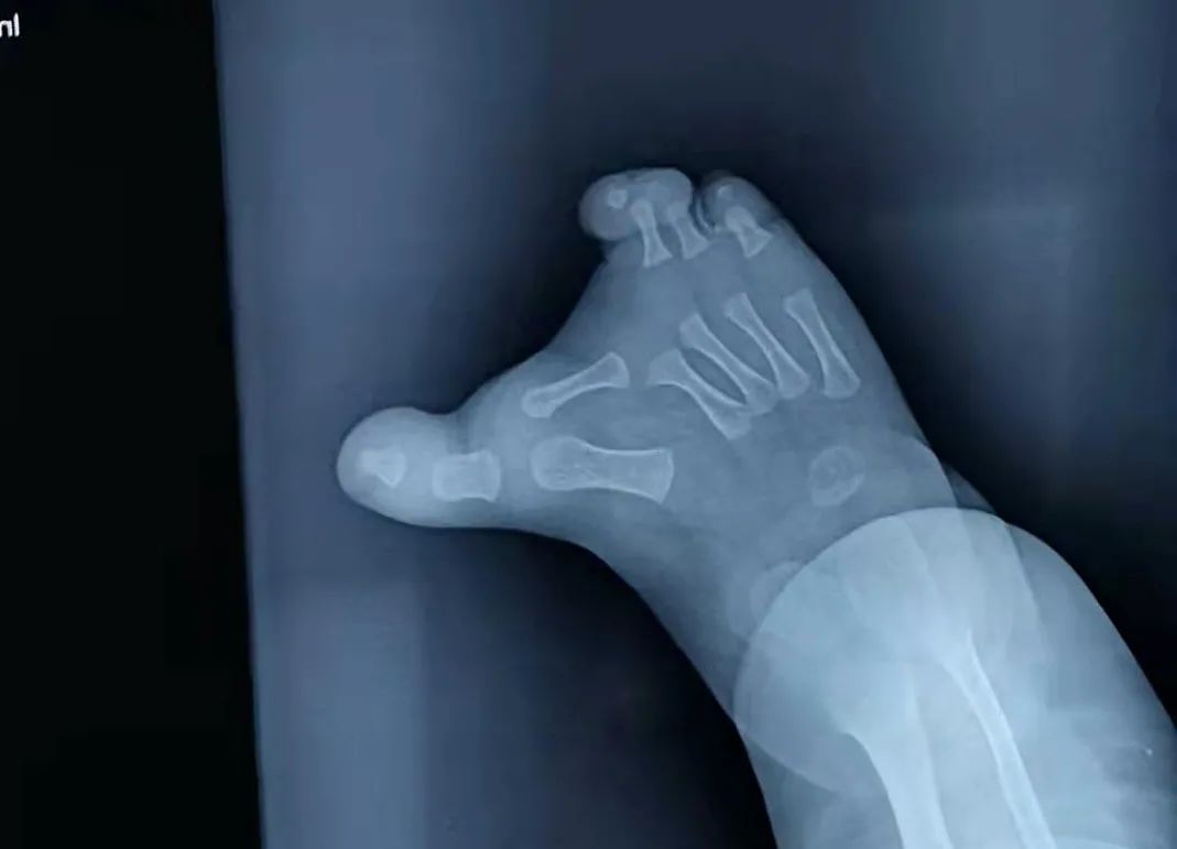 “30岁怀孕，6个月时发现宝宝脚有问题。”妈妈说着说着就哭了休闲区蓝鸢梦想 - Www.slyday.coM