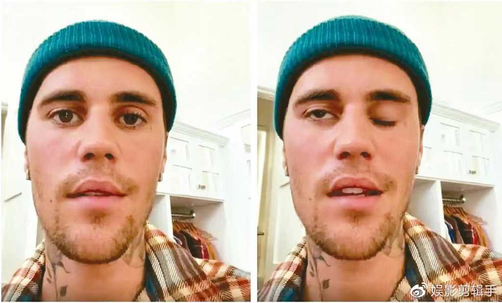 贾斯汀比伯因身体健康问题，发文停工休养，取消世界巡回演唱会休闲区蓝鸢梦想 - Www.slyday.coM