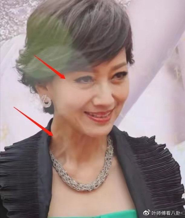 赵雅芝真的老了脸部妆容精致却难掩皱纹脖子皮肤也松弛不堪