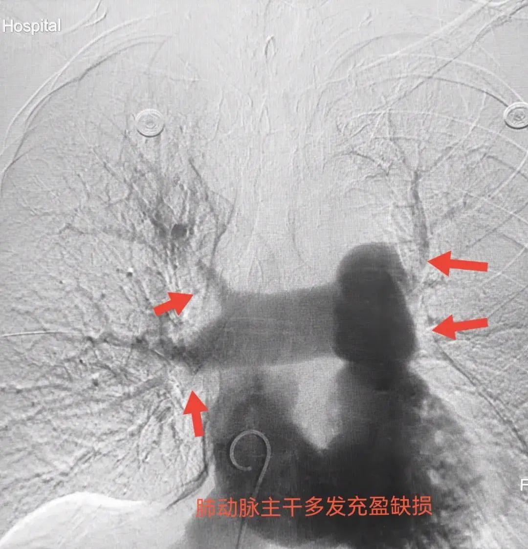 漳州一老奶奶长时间躺着玩手机，差点把命玩丢了！休闲区蓝鸢梦想 - Www.slyday.coM