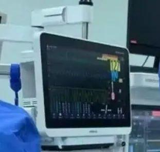 1岁男童误把洗衣凝珠当糖果吞下大半包，疯狂咳嗽、嘴巴发麻？医生竟然这么说...休闲区蓝鸢梦想 - Www.slyday.coM