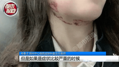 行走的硫酸！遇到这种虫子您可千万别用手拍…休闲区蓝鸢梦想 - Www.slyday.coM