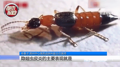 行走的硫酸！遇到这种虫子您可千万别用手拍…休闲区蓝鸢梦想 - Www.slyday.coM