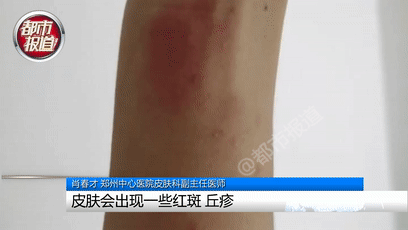 行走的硫酸！遇到这种虫子您可千万别用手拍…休闲区蓝鸢梦想 - Www.slyday.coM