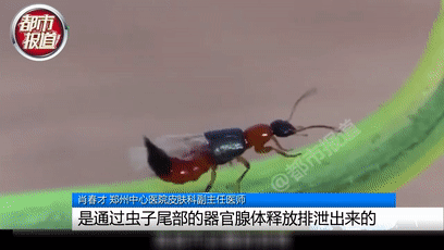 行走的硫酸！遇到这种虫子您可千万别用手拍…休闲区蓝鸢梦想 - Www.slyday.coM