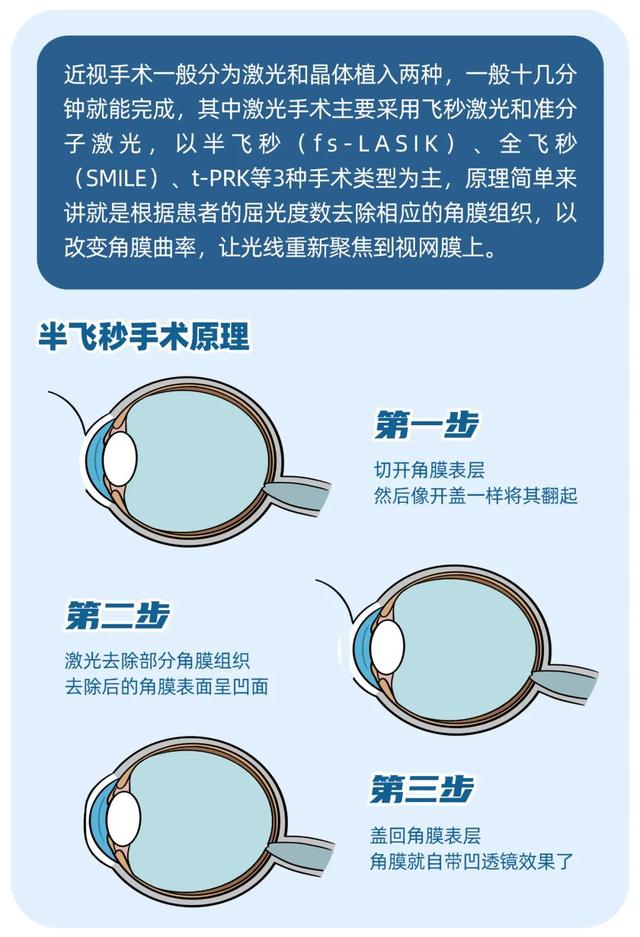 近视手术能不能做？想做又怕后遗症？你需要这篇科普休闲区蓝鸢梦想 - Www.slyday.coM