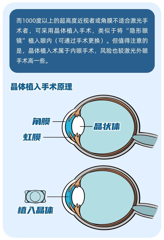 近视手术能不能做？想做又怕后遗症？你需要这篇科普休闲区蓝鸢梦想 - Www.slyday.coM