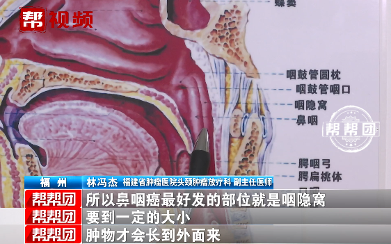15岁少年头痛到夜不能寐,医生在他鼻腔后方发现了致命病因!|鼻咽癌|鼻腔|头痛_新浪新闻