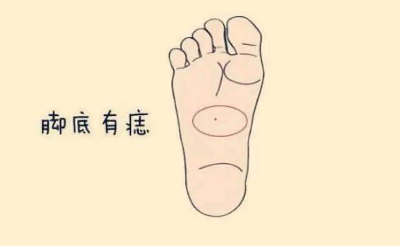 脚底长痣女人的脚底长痣,命中有大福,尤其是在脚心长有吉痣,则这样的