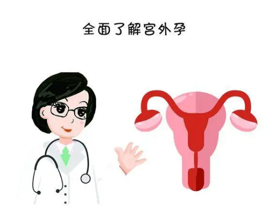 震撼的宫外孕是什么原因造成的的照片