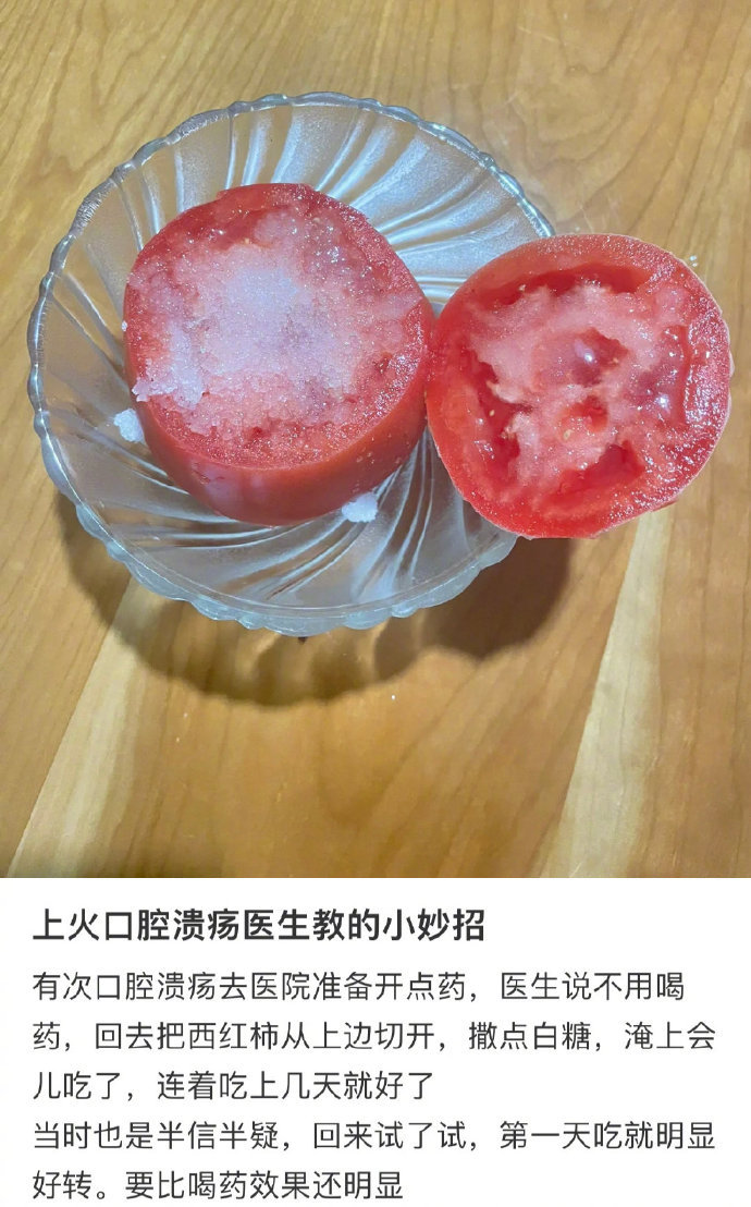 26岁苏女士生孩子后，体重飙升至170斤，殊不知肥胖竟是疾病惹的祸！