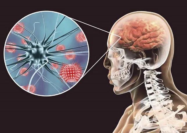 新刊战胜脑膜炎