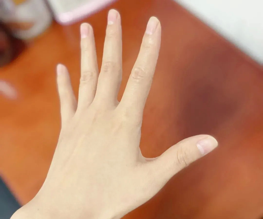 【吃惊】肺好的人,手上一般没有这3个"标记",若你也是,肺还不错__财经