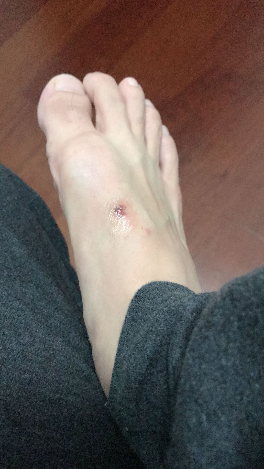 傍晚回来换了双拖鞋去楼下磕破脚_高清图集_新浪网