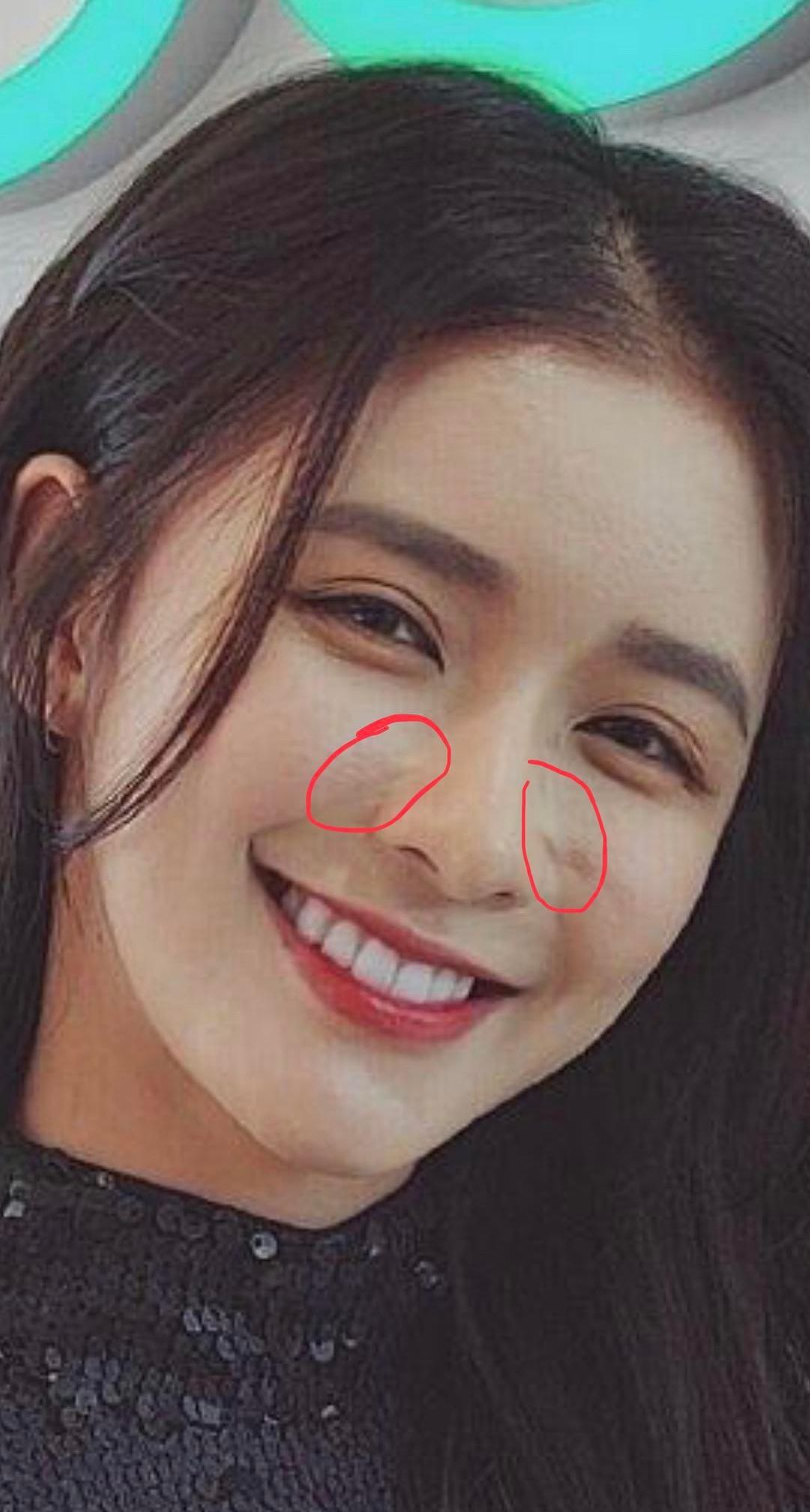 蔡卓宜,越看整容的痕迹就越明显.