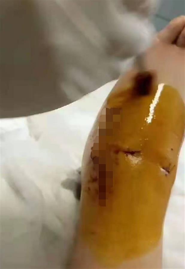 初中女生被同学罚深蹲致残，生活老师在旁助威，四川合江教育局回应休闲区蓝鸢梦想 - Www.slyday.coM