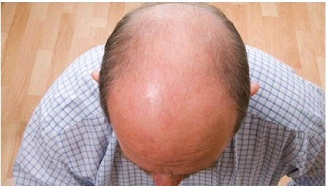 男性衰老时,可能会有4个"破绽",假如都占,要及时学会保养|男人|身体