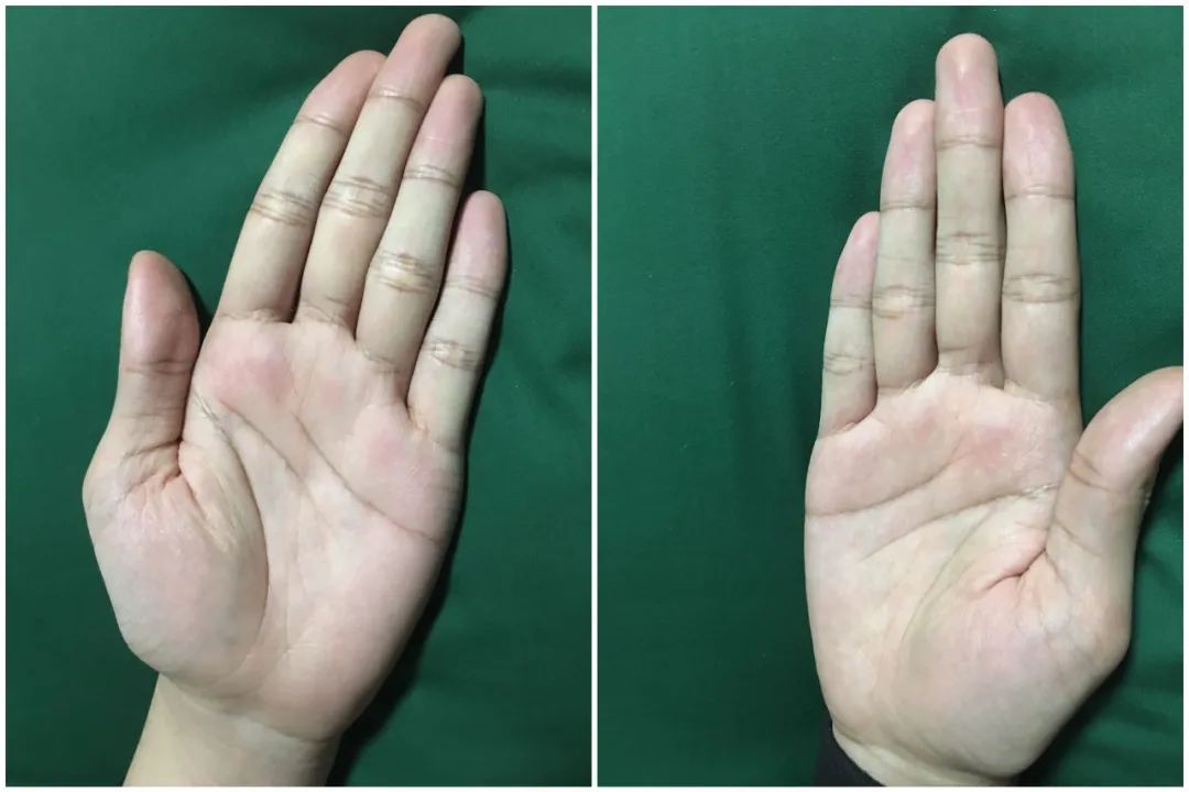 相叔解答第十六期|面相|手相_新浪新闻