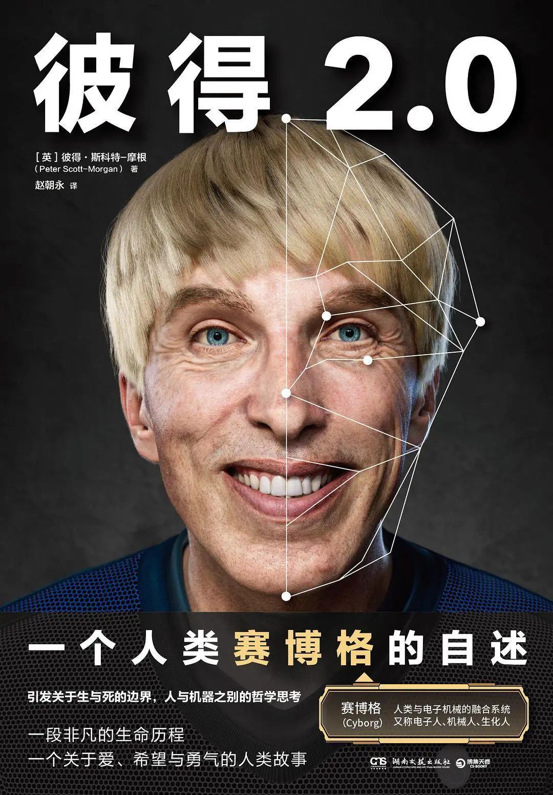 再见彼得20世界上第一个真正的赛博格宣告死亡