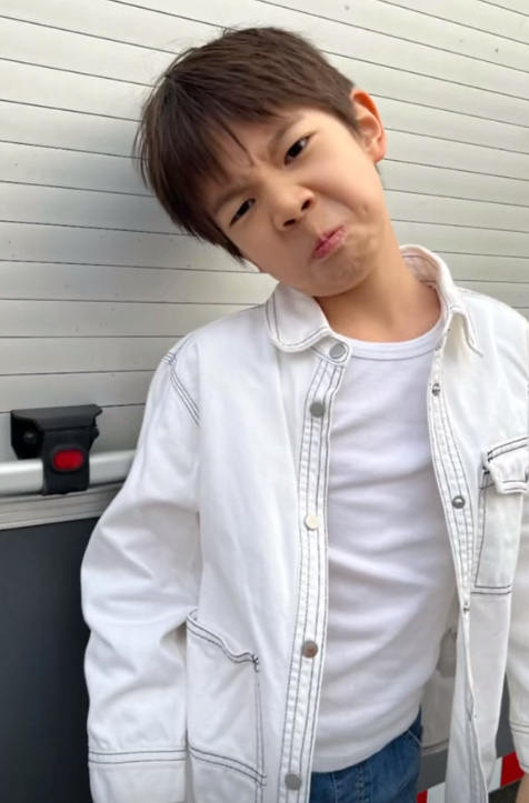 霍思燕晒儿子正脸照,嗯哼嘴巴凸起明显被指腺样体面