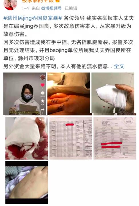 滁州一女子举报遭民警丈夫多次家暴 右手指肌腱断裂 曾被要求下跪认错