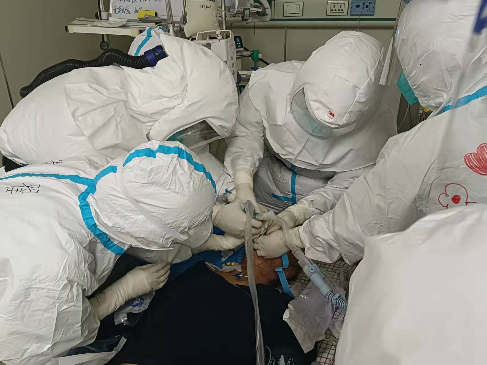 为新冠肺炎重症患者进行气管插管唯有拼尽全力