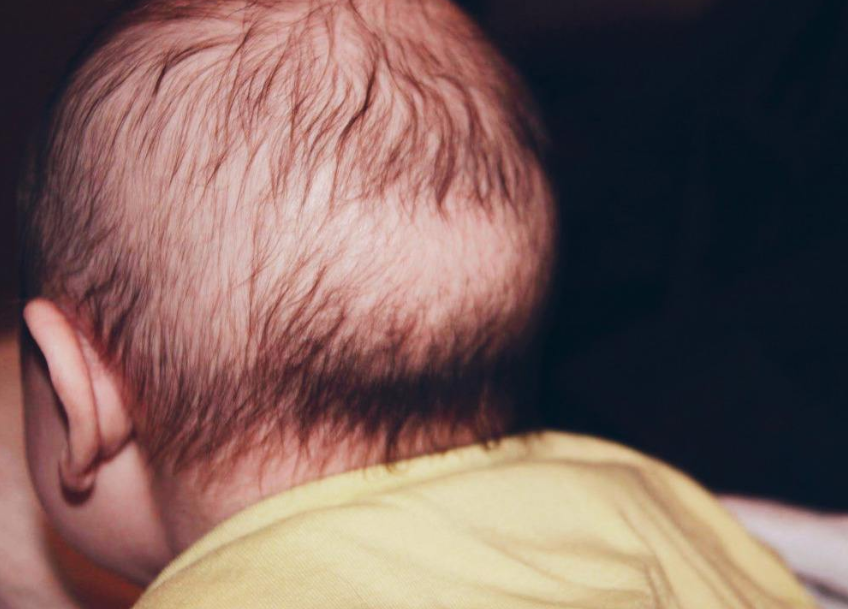 飞快!宝宝头发稀少怎么办"助孕包生"-纳米博客