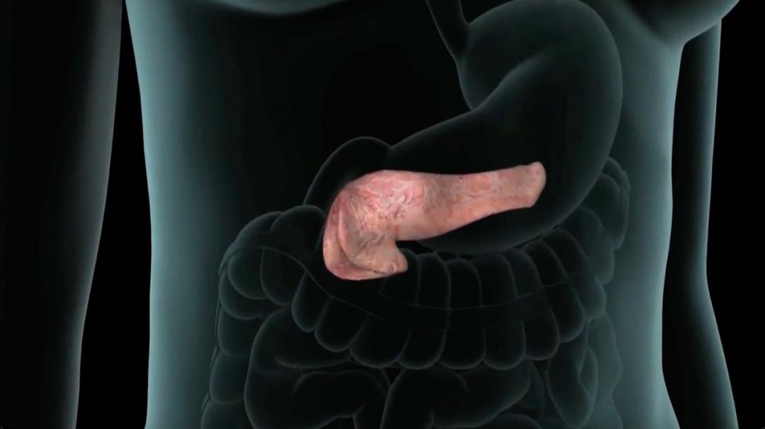 未来，糖尿病能根治了吗？快来看看最新技术是啥？休闲区蓝鸢梦想 - Www.slyday.coM