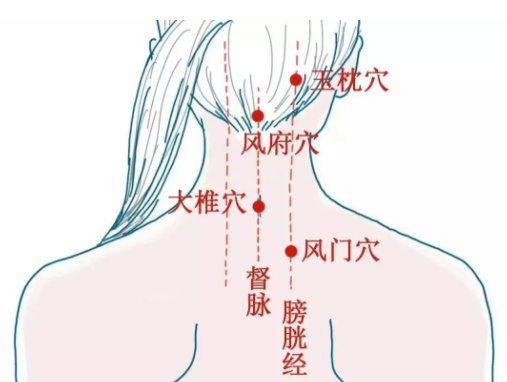 操作:从后发迹沿着督脉及膀胱经往下刮,至局部潮红或者有痧点为止.