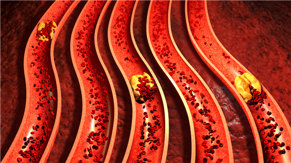 吃三七可以疏通血管?大错特错!真正能通血管的是这6件事情