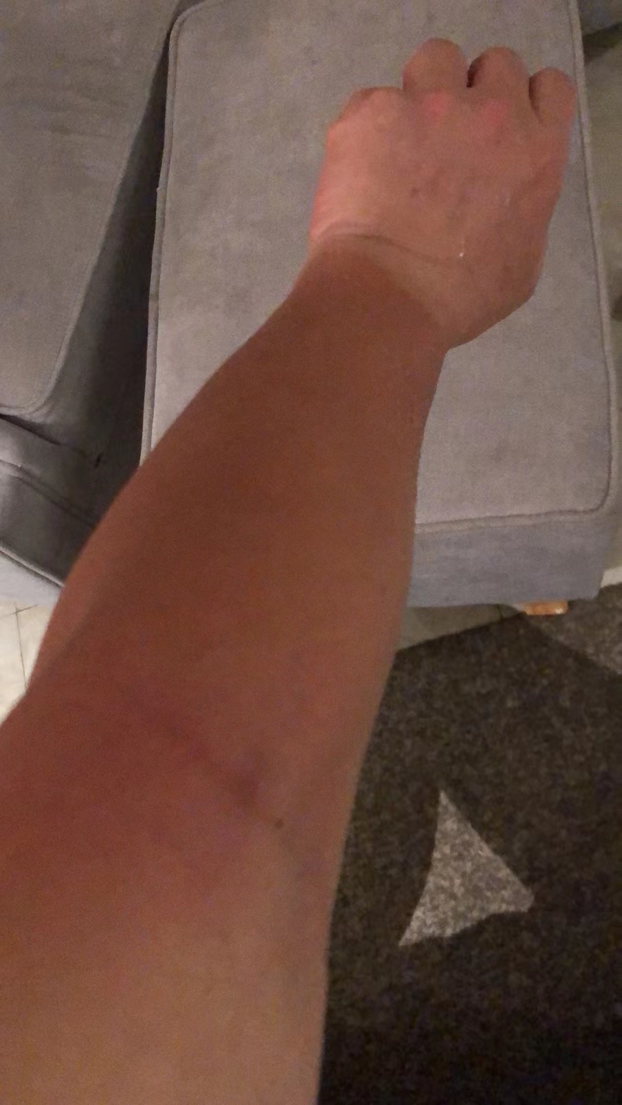 看书找答案.为什么同样晒太阳,我的手臂,腿脚都晒黑了