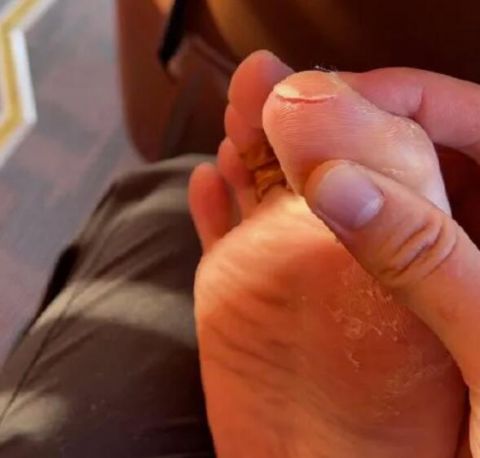 奥运冠军陈雨菲比赛被运动鞋割伤脚趾 李宁回应来了休闲区蓝鸢梦想 - Www.slyday.coM