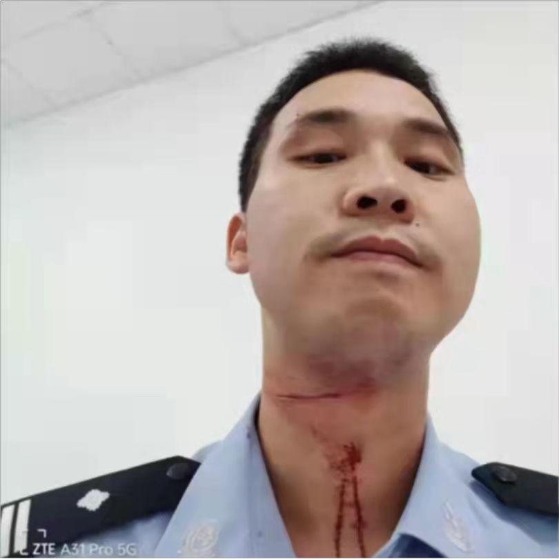 民警抓捕时脖子被划一道10厘米长伤口