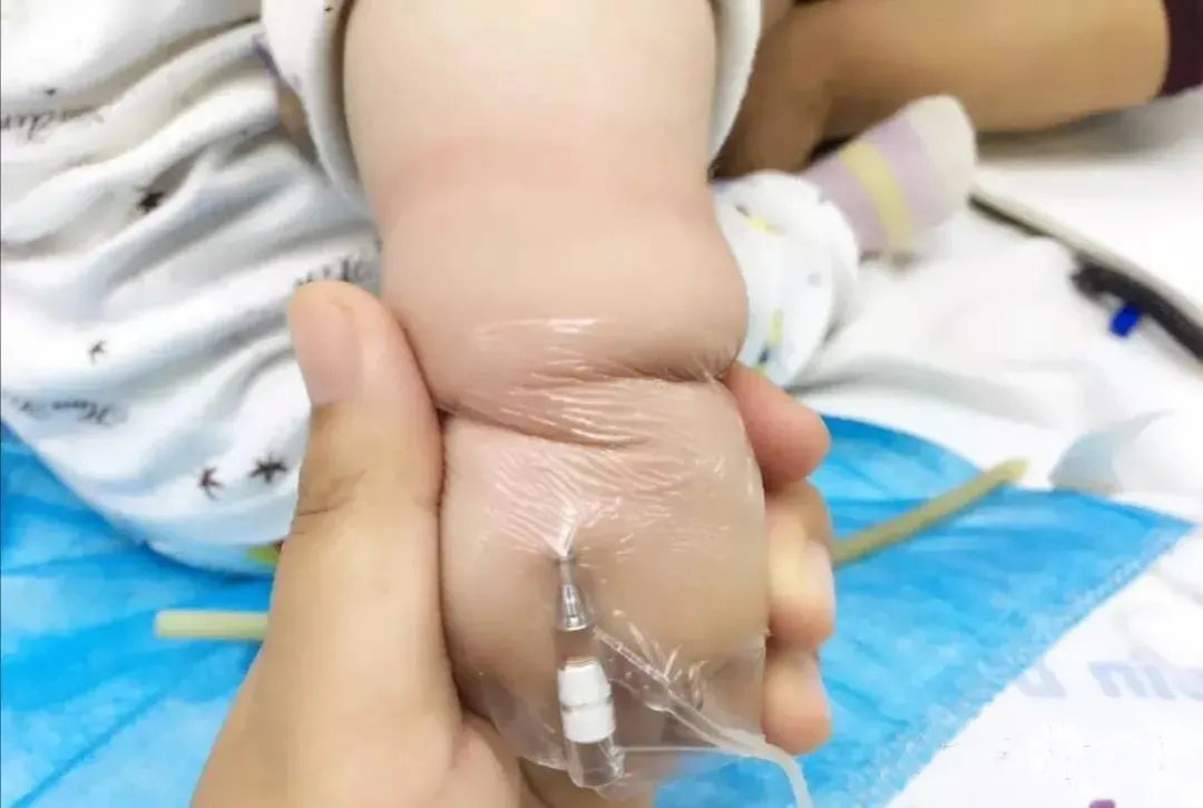 有了这个神器,孩子再也不怕打针了~|留置针|护士|胶布_新浪新闻