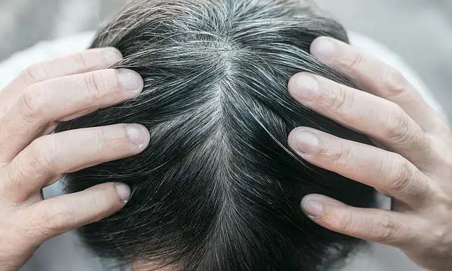 【网络辟谣】白发增多?可能是身体缺这4种营养……|辟谣|头发|白发_新浪新闻