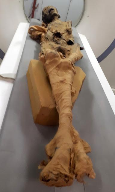 3000年前木乃伊面目狰狞形似痛苦尖叫她到底经历了什么