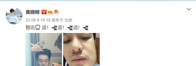 脸肿表情包+1!黄晓明晒拔完智齿后自拍,好像被蜜蜂蛰的狗狗休闲区蓝鸢梦想 - Www.slyday.coM 脸肿表情包+1!黄晓明晒拔完智齿后自拍,好像被蜜蜂蛰的狗狗休闲区蓝鸢梦想 - Www.slyday.coM