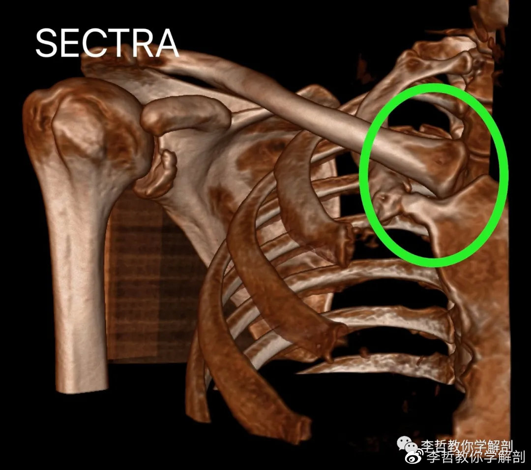 上肢在人体动作的非凡意义---本文图片均为sectra真人三维重建