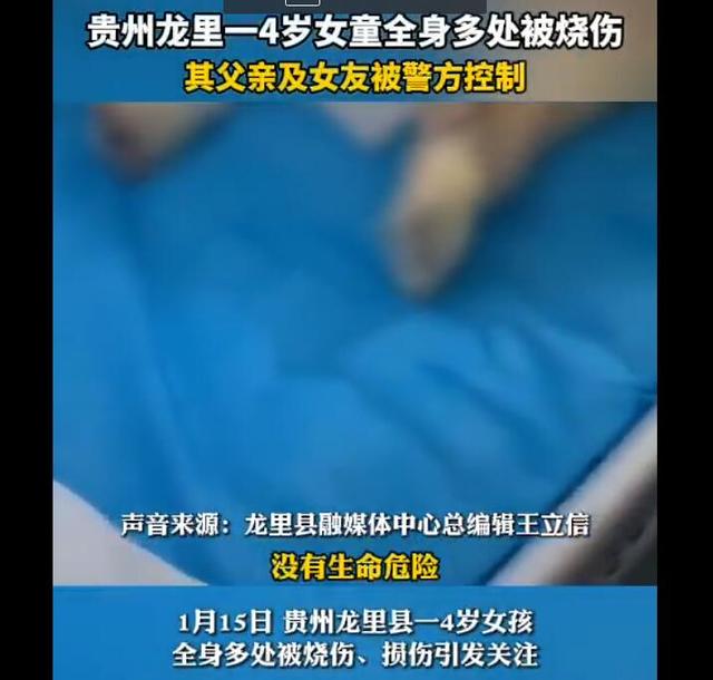 全身多处烧伤！4岁女孩被虐待 父亲及其女友被控制休闲区蓝鸢梦想 - Www.slyday.coM