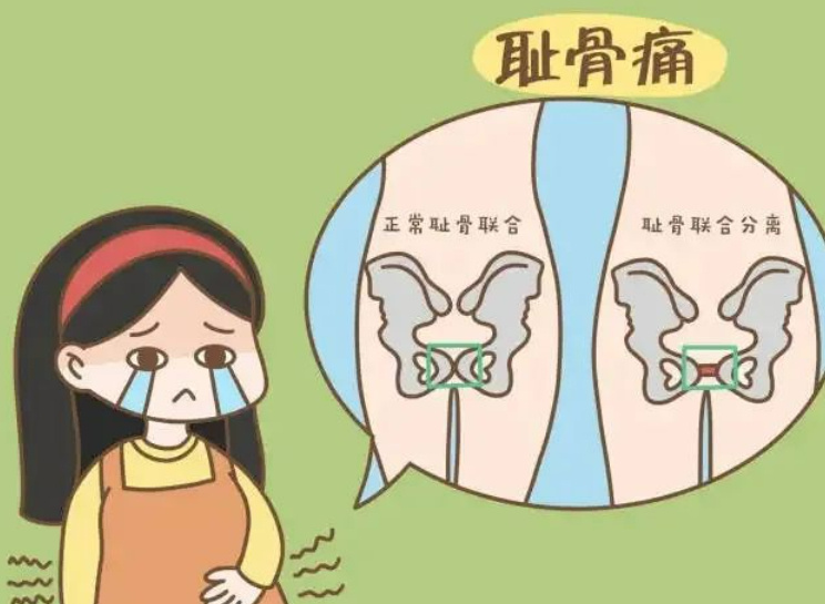 一般正常人耻骨间隙为4～6mm,孕期可增宽2～3mm.